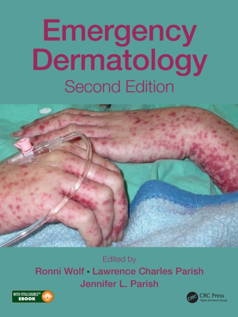 Emergency Dermatology, PDF eBook