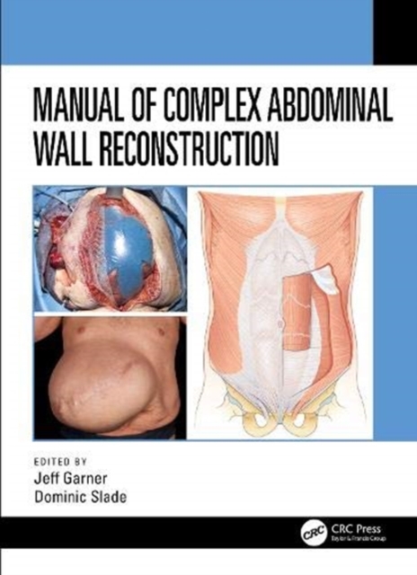 Manual of Complex Abdominal Wall Reconstruction, Paperback / softback Book