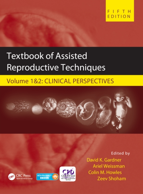 Textbook of Assisted Reproductive Techniques : Two Volume Set, PDF eBook