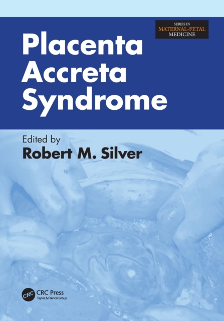 Placenta Accreta Syndrome, Paperback / softback Book