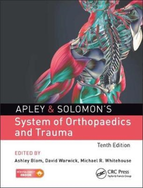 Apley & Solomon's System of Orthopaedics and Trauma, Hardback Book