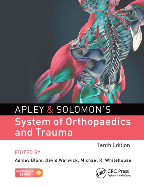 Apley & Solomon's System of Orthopaedics and Trauma, EPUB eBook