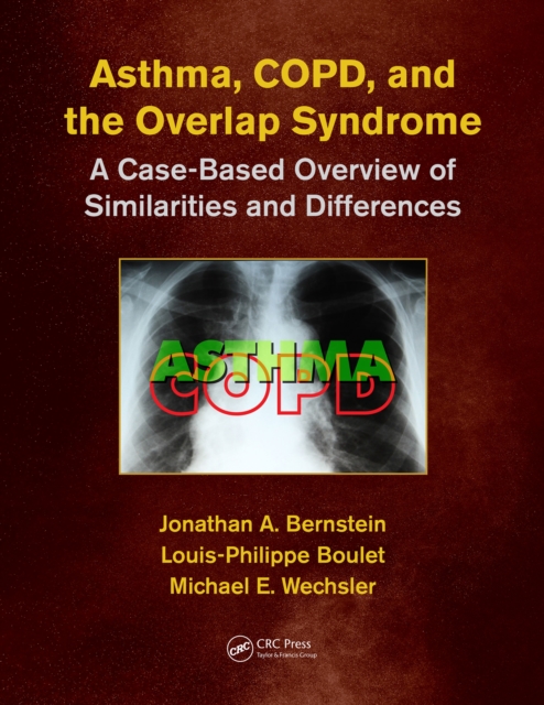Asthma, COPD, and Overlap : A Case-Based Overview of Similarities and Differences, Paperback / softback Book