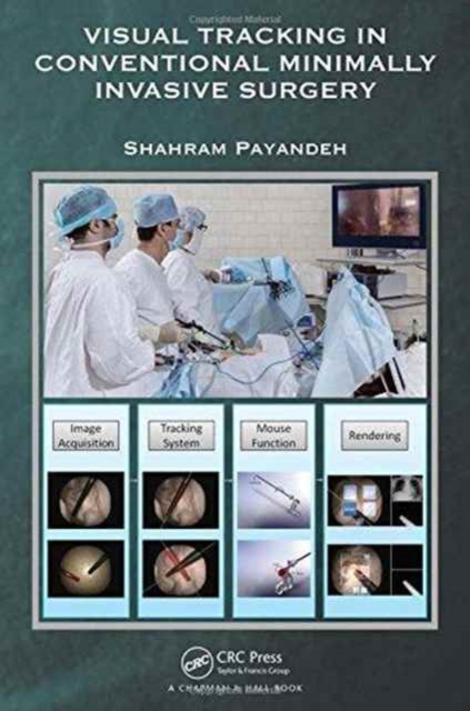 Visual Tracking in Conventional Minimally Invasive Surgery, Hardback Book
