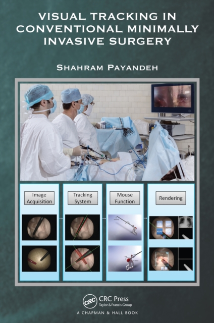 Visual Tracking in Conventional Minimally Invasive Surgery, PDF eBook