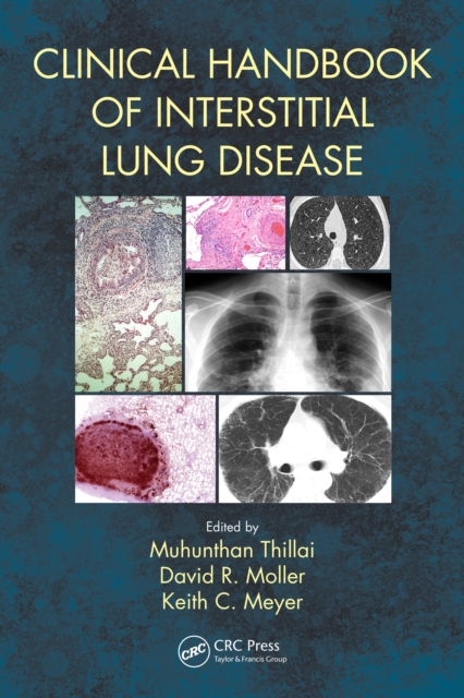 Clinical Handbook of Interstitial Lung Disease, PDF eBook