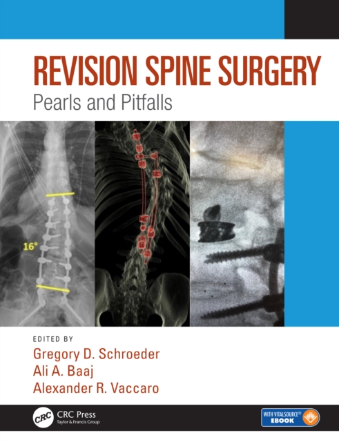 Revision Spine Surgery : Pearls and Pitfalls, EPUB eBook