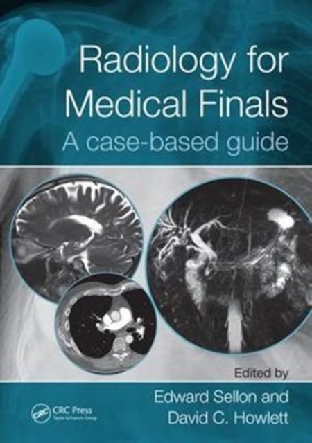 Radiology for Medical Finals : A case-based guide, Paperback / softback Book