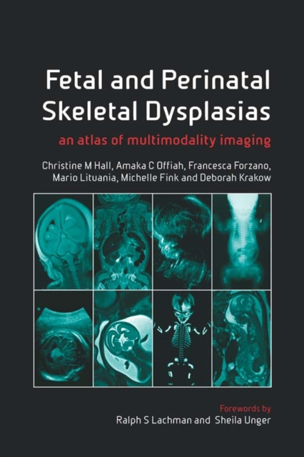 Fetal and Perinatal Skeletal Dysplasias : an Atlas of Multimodality Imaging, PDF eBook