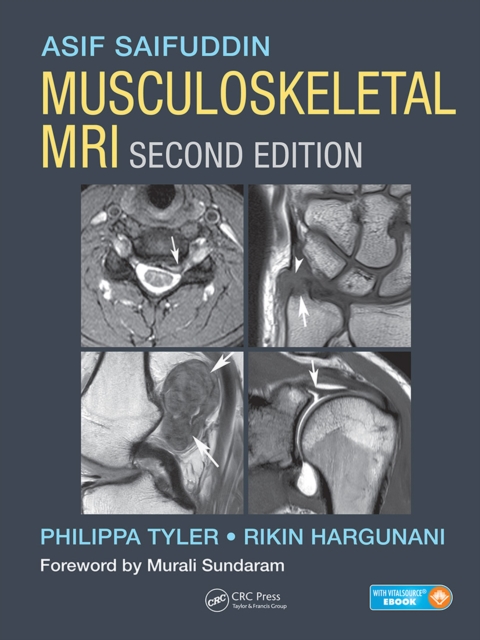 Musculoskeletal MRI, EPUB eBook