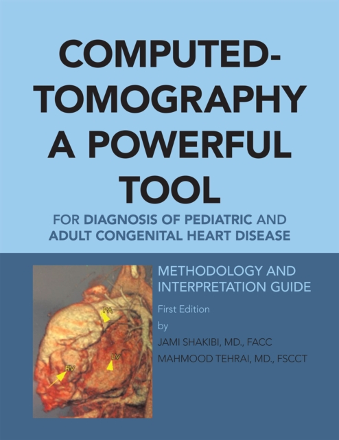 Computed-Tomography a Powerful Tool for Diagnosis of Pediatric and Adult Congenital Heart Disease : Methodology and Interpretation Guide, EPUB eBook