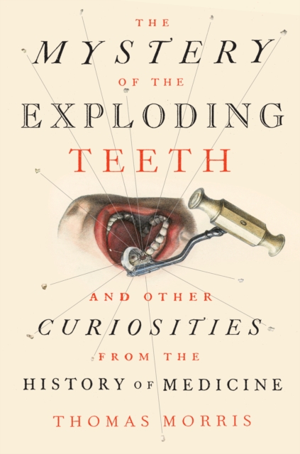 Mystery of the Exploding Teeth, EPUB eBook