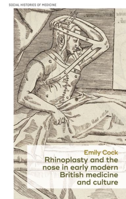 Rhinoplasty and the Nose in Early Modern British Medicine and Culture, Hardback Book