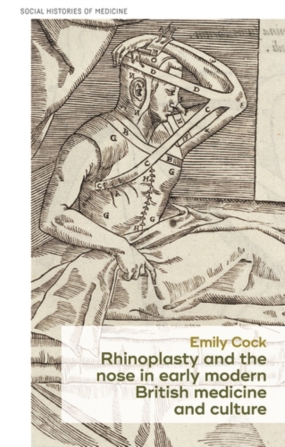 Rhinoplasty and the nose in early modern British medicine and culture, PDF eBook