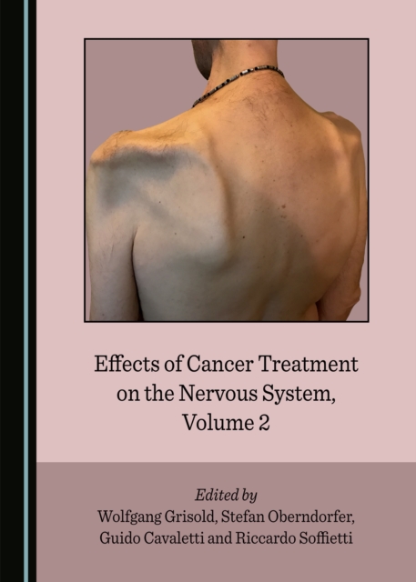 None Effects of Cancer Treatment on the Nervous System, Volume 2, PDF eBook