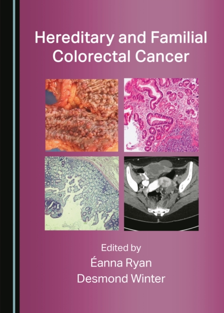 None Hereditary and Familial Colorectal Cancer, PDF eBook