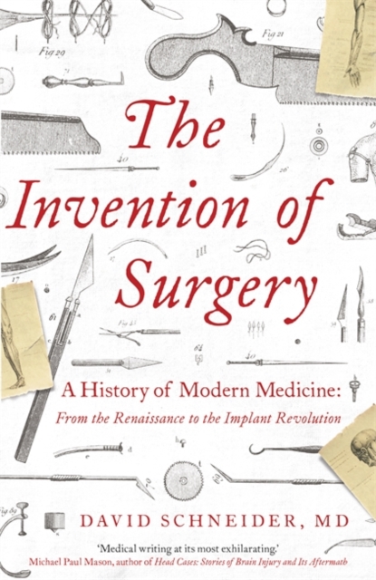 The Invention of Surgery, Paperback / softback Book