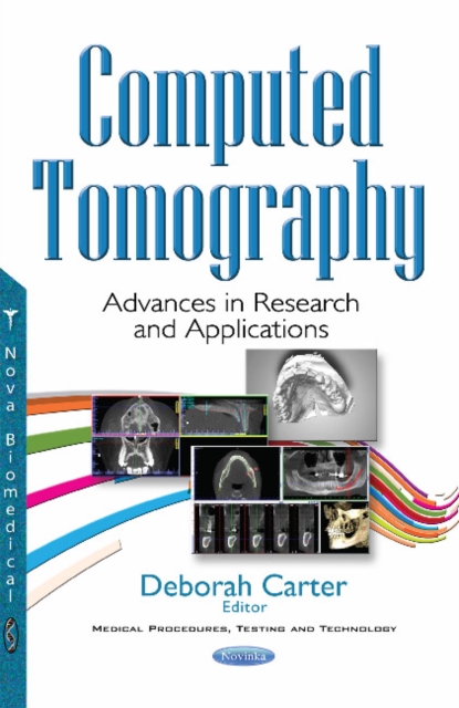 Computed Tomography : Advances in Research & Applications, Paperback / softback Book