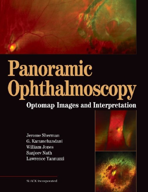 Panoramic Ophthalmoscopy : Optomap Images and Interpretation, Hardback Book