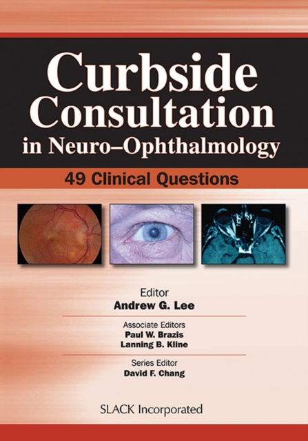 Curbside Consultation in Neuro-ophthalmology : 49 Clinical Questions, Paperback Book