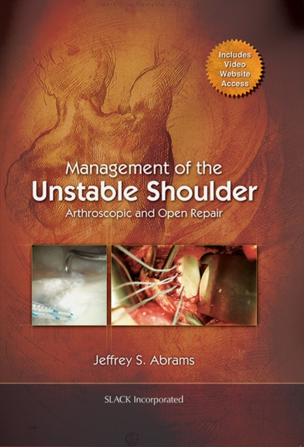 Management of the Unstable Shoulder : Arthroscopic and Open Repair, Hardback Book