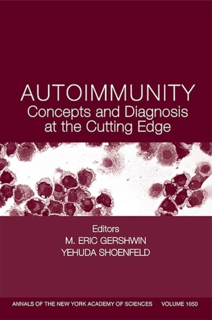 Autoimmunity : Concepts and Diagnosis at the Cutting Edge, Paperback / softback Book