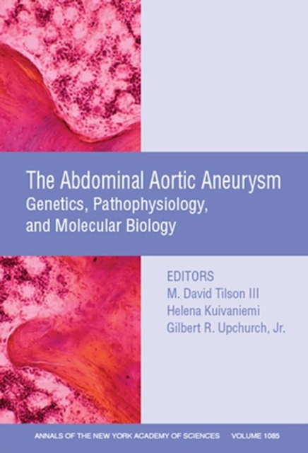 Abdominal Aortic Aneurysm : Genetics, Pathophysiology, and Molecular Biology, Volume 1085, Paperback / softback Book