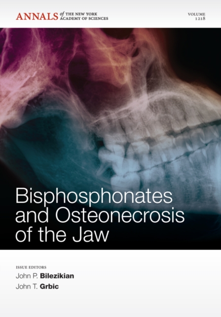 Bisphosphonates and Osteonecrosis of the Jaw, Volume 1218, Paperback / softback Book