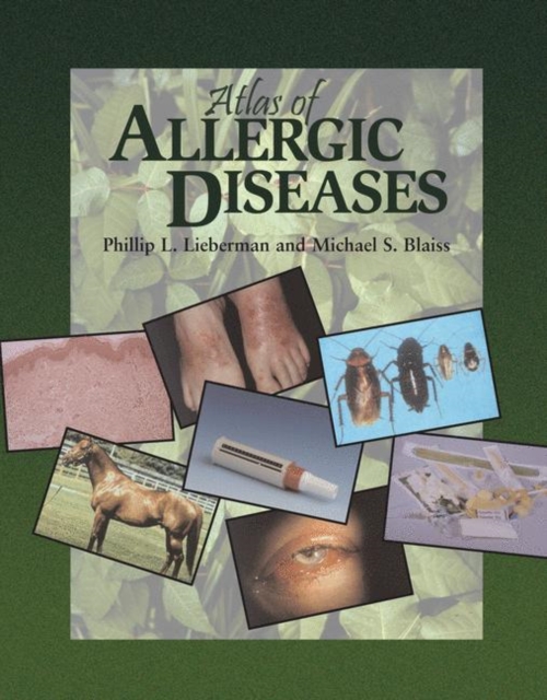 Atlas of Allergic Diseases, Hardback Book