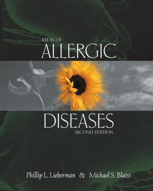 Atlas of Allergic Diseases, Hardback Book