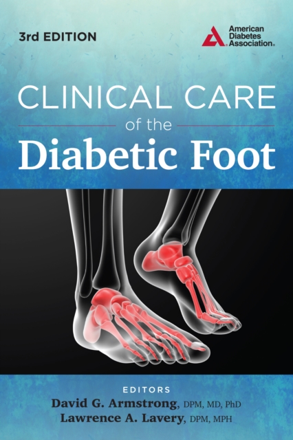 Clinical Care of the Diabetic Foot, EPUB eBook