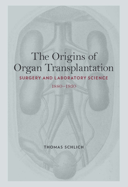 The Origins of Organ Transplantation : Surgery and Laboratory Science, 1880-1930, PDF eBook