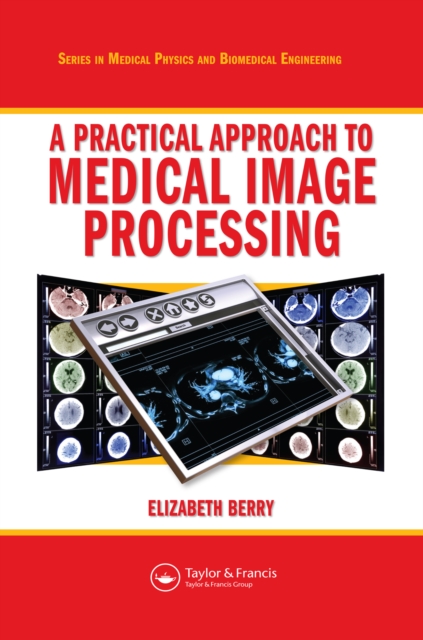 A Practical Approach to Medical Image Processing, PDF eBook