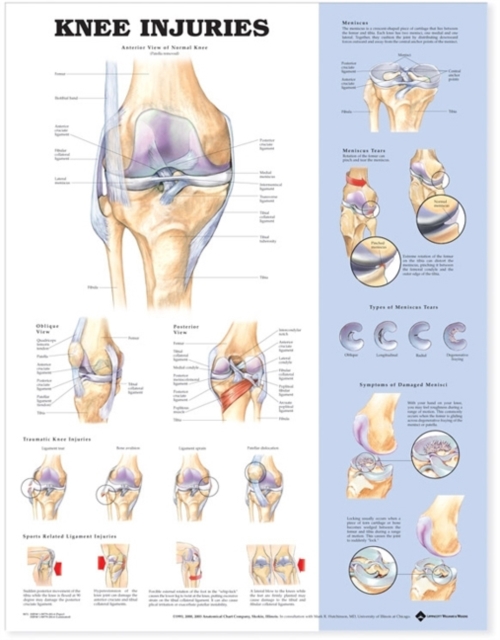 Knee Injuries Anatomical Chart, Wallchart Book