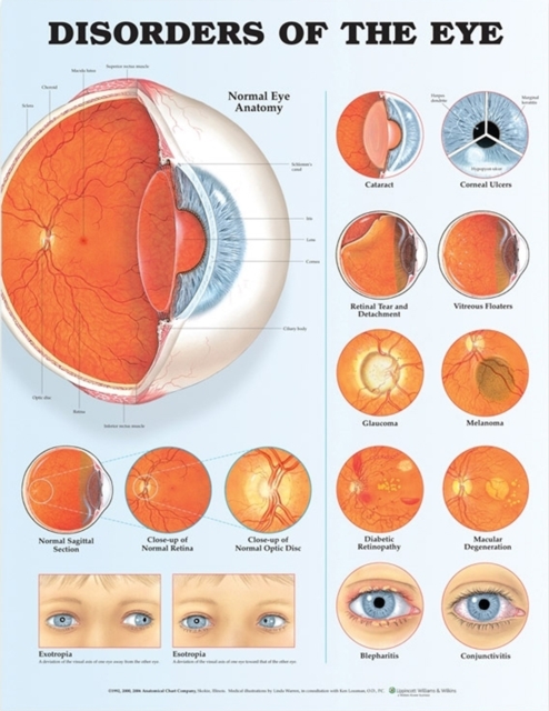 Disorders of the Eye Anatomical Chart, Wallchart Book