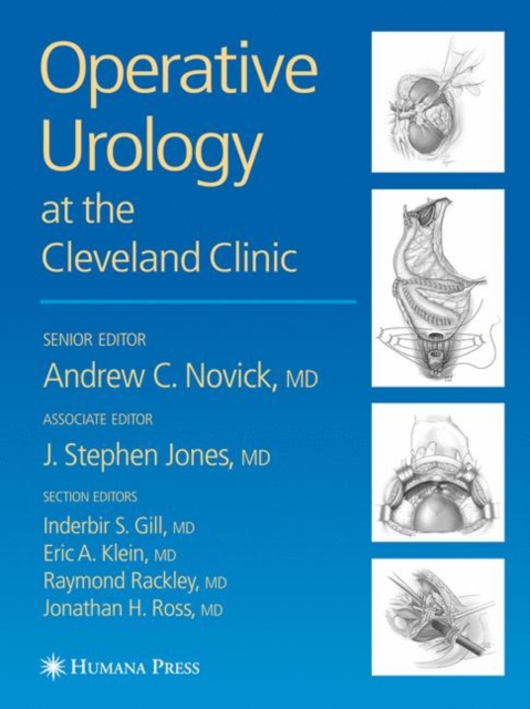 Operative Urology, Hardback Book