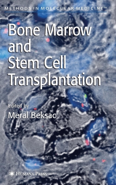 Bone Marrow and Stem Cell Transplantation, Hardback Book