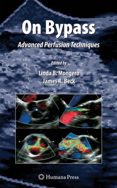 On Bypass : Advanced Perfusion Techniques, Hardback Book
