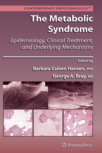 The Metabolic Syndrome: : Epidemiology, Clinical Treatment, and Underlying Mechanisms, Hardback Book