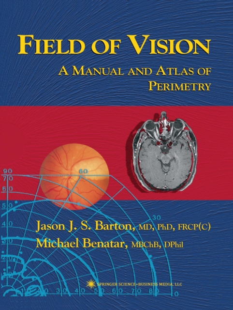 Field of Vision : A Manual and Atlas of Perimetry, PDF eBook