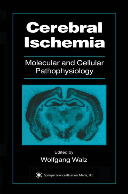 Cerebral Ischemia : Molecular and Cellular Pathophysiology, PDF eBook