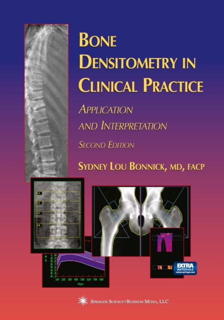 Bone Densitometry in Clinical Practice : Application and Interpretation, PDF eBook