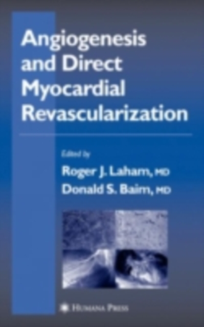 Angiogenesis and Direct Myocardial Revascularization, PDF eBook