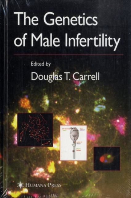 The Genetics of Male Infertility, PDF eBook