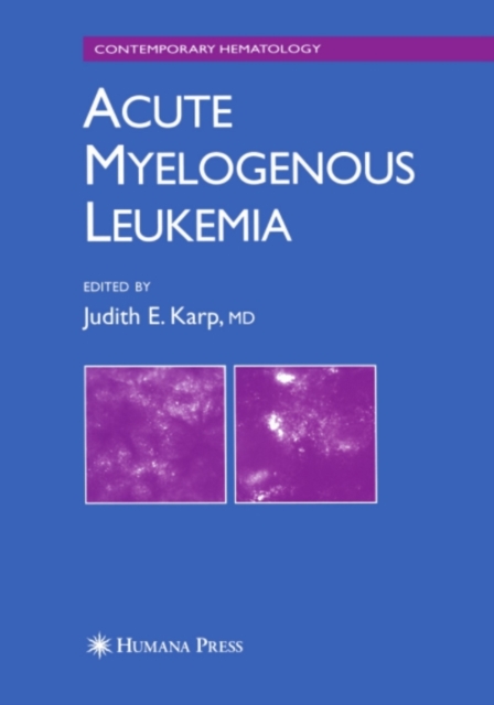 Acute Myelogenous Leukemia, PDF eBook
