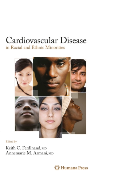 Cardiovascular Disease in Racial and Ethnic Minorities, PDF eBook