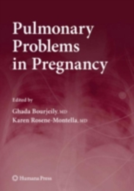 Pulmonary Problems in Pregnancy, PDF eBook