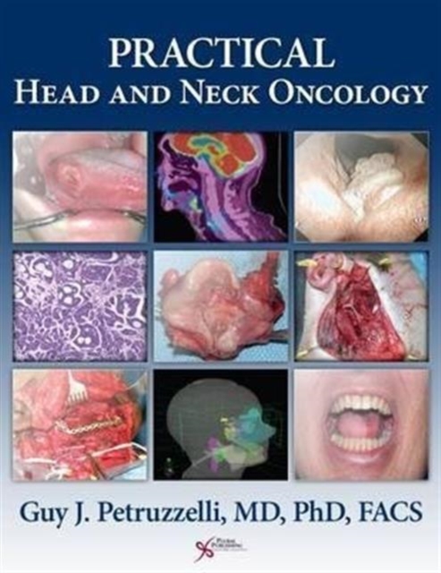 Practical Head and Neck Oncology, Mixed media product Book