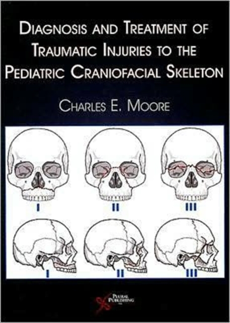 Diagnosis and Treatment of Traumatic Injuries to the Pediatric Craniofacial Skeleton, Hardback Book