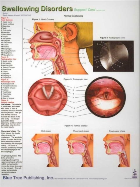 Swallowing Disorders, Digital (on physical carrier) Book